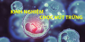 Bỏ túi kinh nghiệm trước và sau khi chọc hút trứng 4