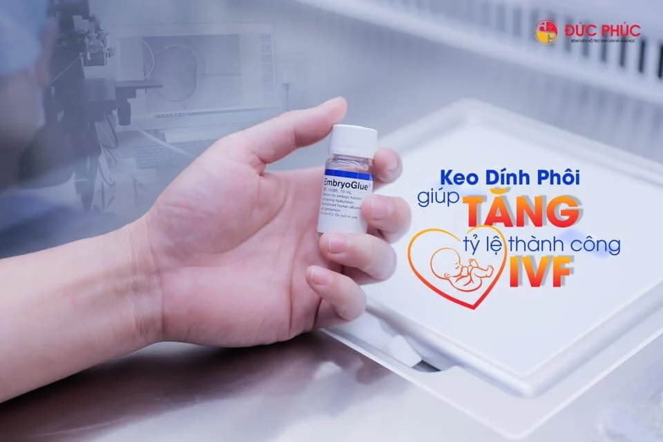 5 phút hiểu tất tần tật về keo dính phôi