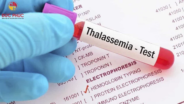 Thalassemia căn bệnh tan máu bẩm sinh