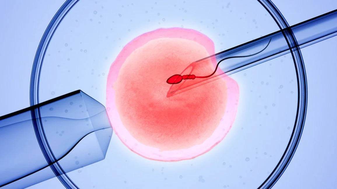 Thụ tinh ống nghiệm (IVF) thất bại do nhiều nguyên nhân khác nhau ( Ảnh internet )