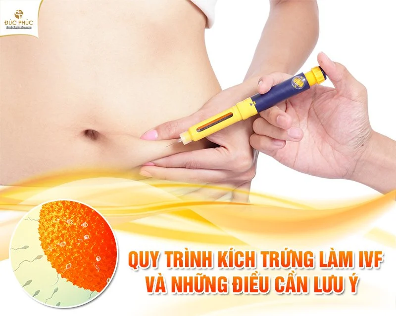 Sau khi thăm khám siêu âm và xét nghiệm, bác sĩ sẽ quyết định phác đồ kích trứng phù hợp