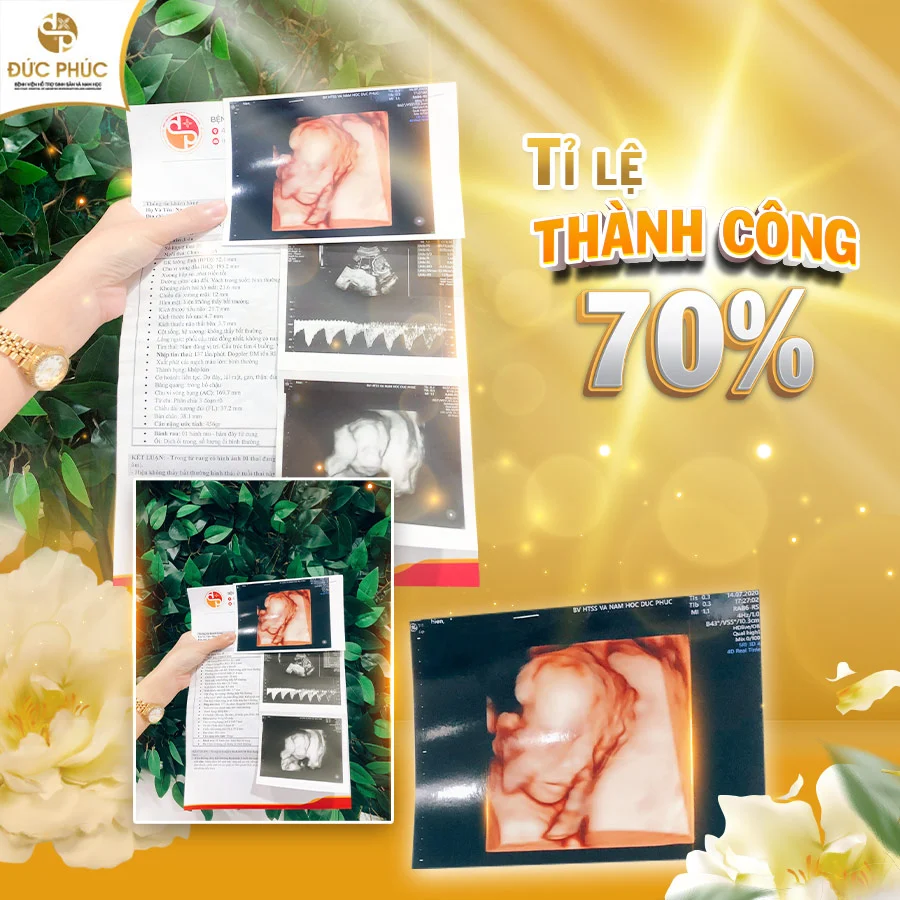 IVF 55 triệu cho tỷ lệ thành công lên tới 70%