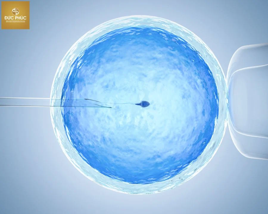 Chuyển phôi là một trong những bước quan trọng nhất khi thực hiện IVF