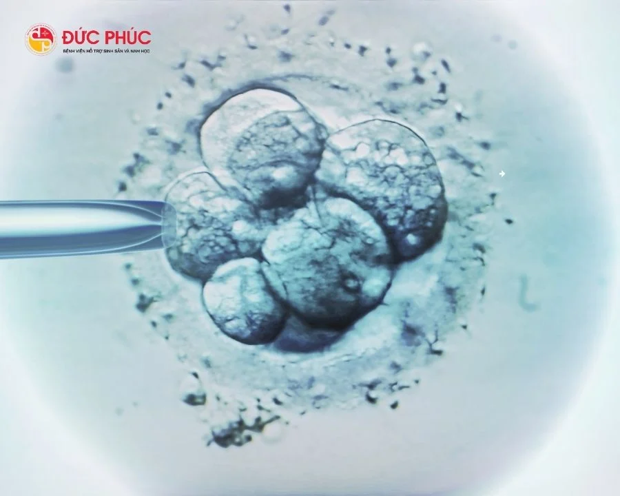 Phôi sẽ được nuôi cấy trong phòng thí nghiệm để đảm bảo điều kiện tốt nhất