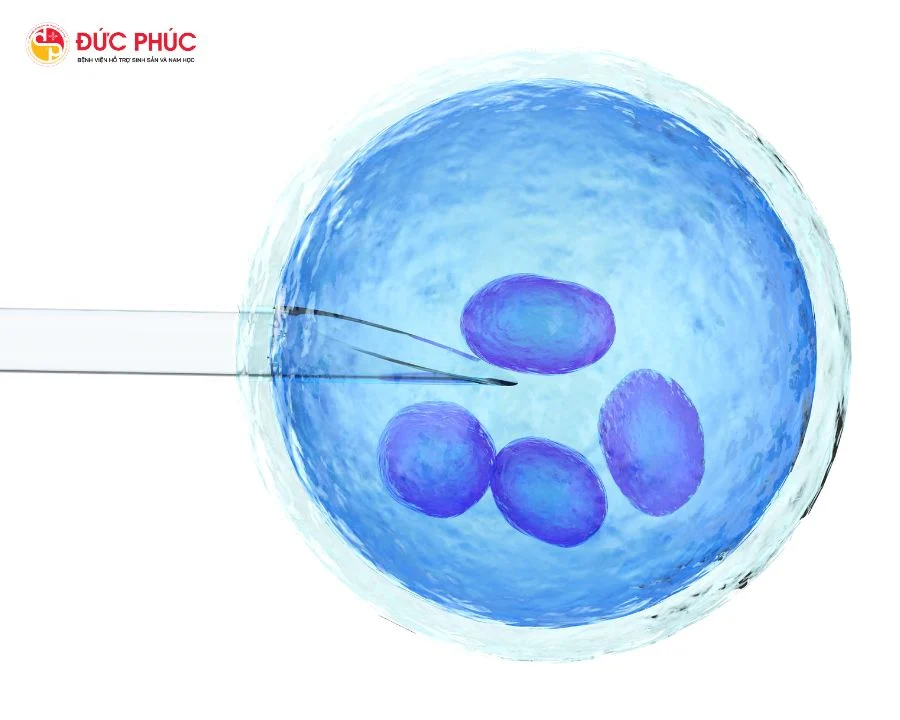 Chọc hút trứng là một công đoạn quan trọng trong IVF