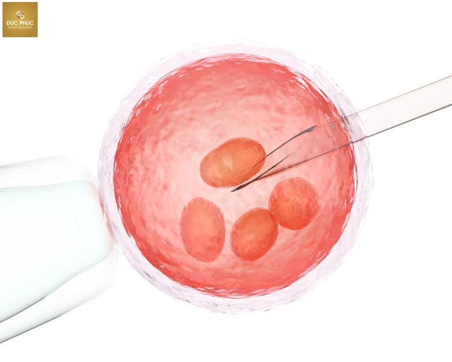 Chọc hút trứng là một trong những chu kỳ quan trọng của thụ tinh trong ống nghiệm IVF