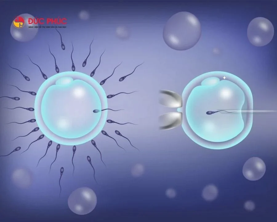 IUI và IVF là hai phương pháp điều trị vô sinh hiếm muộn phổ biến nhất hiện nay