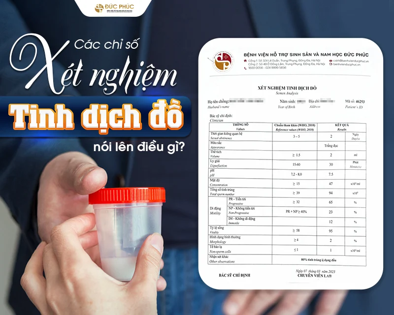 Tinh dịch đồ là xét nghiệm đánh giá tinh trùng