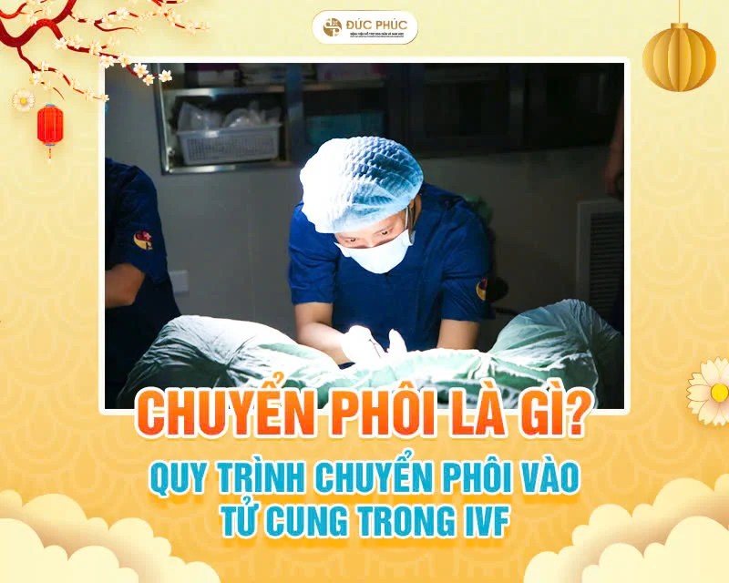 Chuyển phôi là một thủ thuật nằm trong quy trình thụ tinh trong ống nghiệm IVF