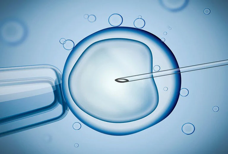 IVF có thể nói rằng đây là một trong những kỹ thuật hỗ trợ sinh sản phổ biến nhất hiện nay