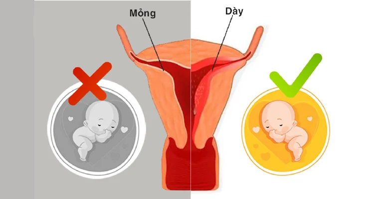 Niêm mạc tử cung uyết định quá trình làm tổ và sự phát triển của thai nhi