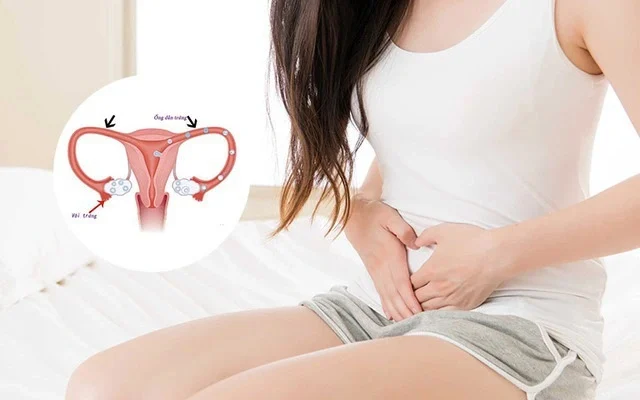 Tắc vòi trứng thường gây ra các cơn đau tức ở vùng bụng dưới