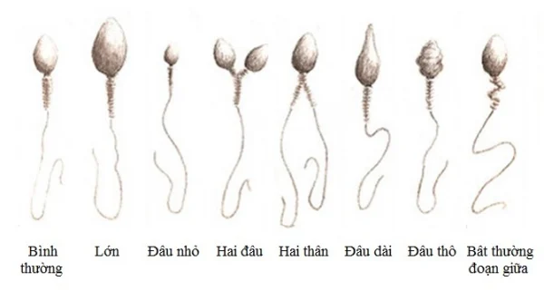 Tinh trùng dị dạng có đầu kỳ lạ, có thêm đầu hoặc đuôi