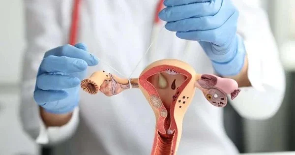 Trường hợp nặng nếu cả hai ống dẫn trứng bị tổn thương phải cắt cả 2