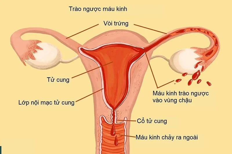 Nội mạc tử cung là lớp tế bào lót bên trong tử cung