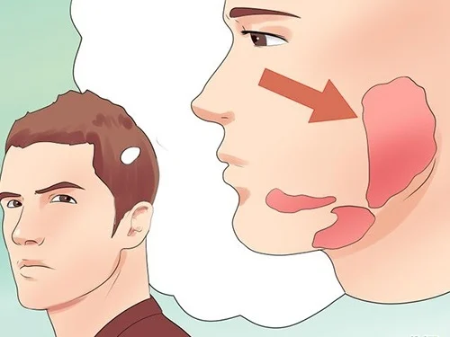 Nam giới mắc quai bị có nguy cơ cao bị viêm tinh hoàn