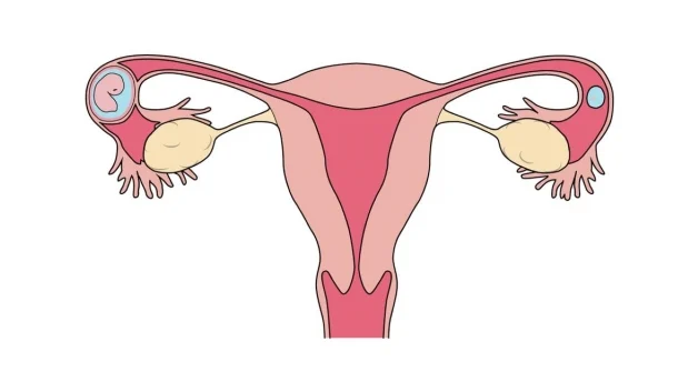 Để phôi có thể làm tổ thuận lợi, bất kỳ bất thường nào trong tử cung cần được xử lý triệt để