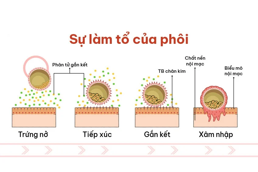 Nếu ho trong giai đoạn đầu sau chuyển phôi khả năng ảnh hưởng đến quá trình làm tổ sẽ cao hơn