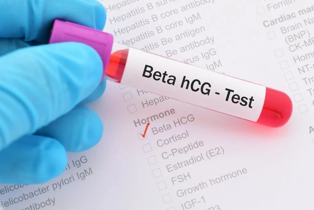 Nếu kết quả xét nghiệm beta HCG âm tính là chuyển phôi đã thất bại