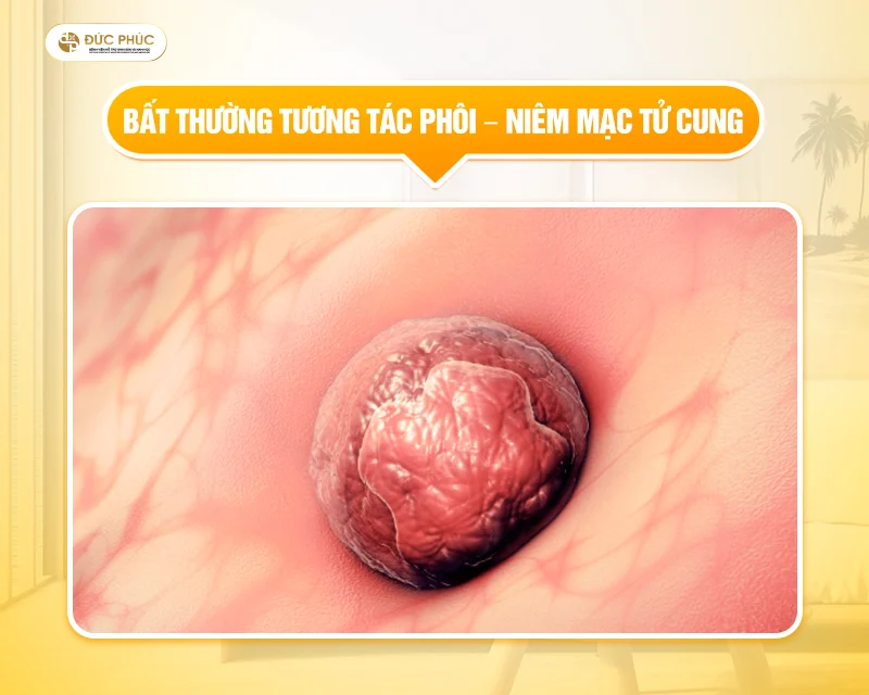 Niêm mạc tử cung có vai trò quan trọng trong quá trình thụ thai