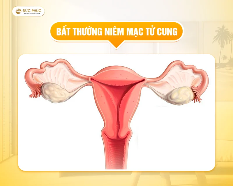 Phôi cần được chuyển vào tử cung vào đúng thời điểm mà niêm mạc tử cung có khả năng tiếp nhận