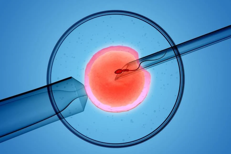Chuyển phôi là một bước quan trọng trong quy trình thụ tinh trong ống nghiệm (IVF)