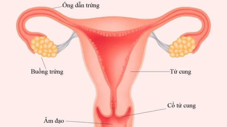 Tắc ống dẫn trứng- một trong những nguyên nhân phổ biến gây vô sinh ở phụ nữ.
