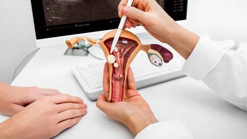 Tắc vòi trứng là một trong những nguyên nhân phổ biến gây vô sinh thứ phát ở phụ nữ