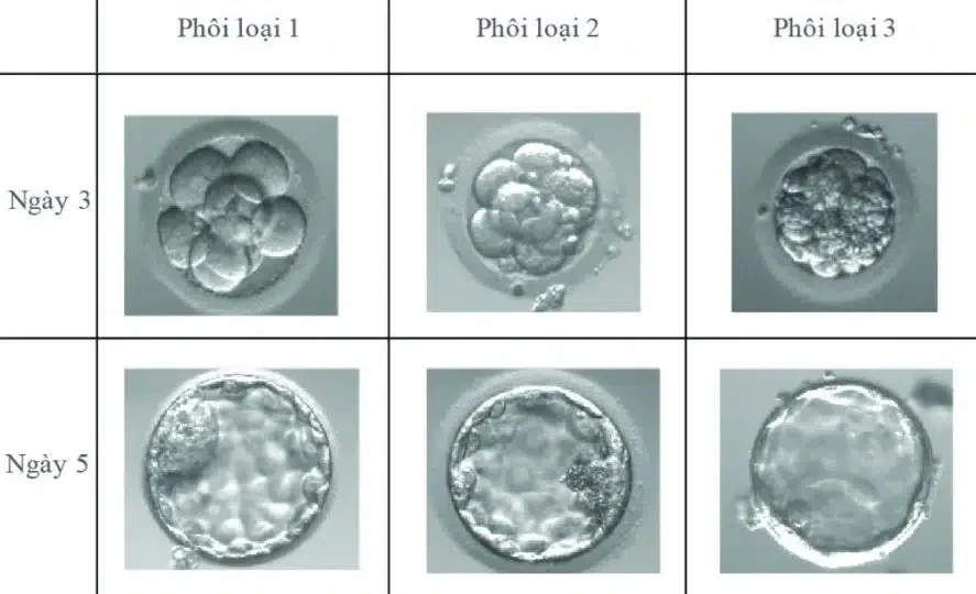 Phôi ngày 5 – giai đoạn tối ưu để đánh giá tổng thể chất lượng