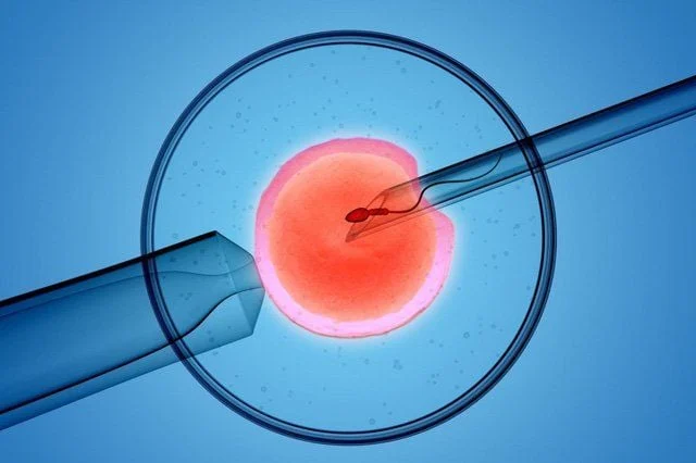IVF cho người suy giảm buồng trứng cần kỹ thuật cao