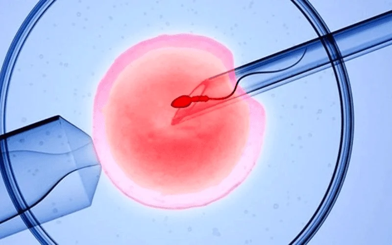 Việc điều trị tinh trùng yếu trước khi làm IVF không phải lúc nào cũng cần thiết