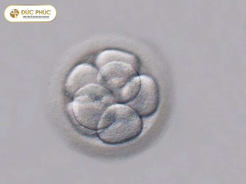 Nên chuyển phôi IVF vào ngày nào?