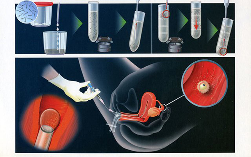 Nhiều phương pháp điều trị phù hợp với từng khách hàng