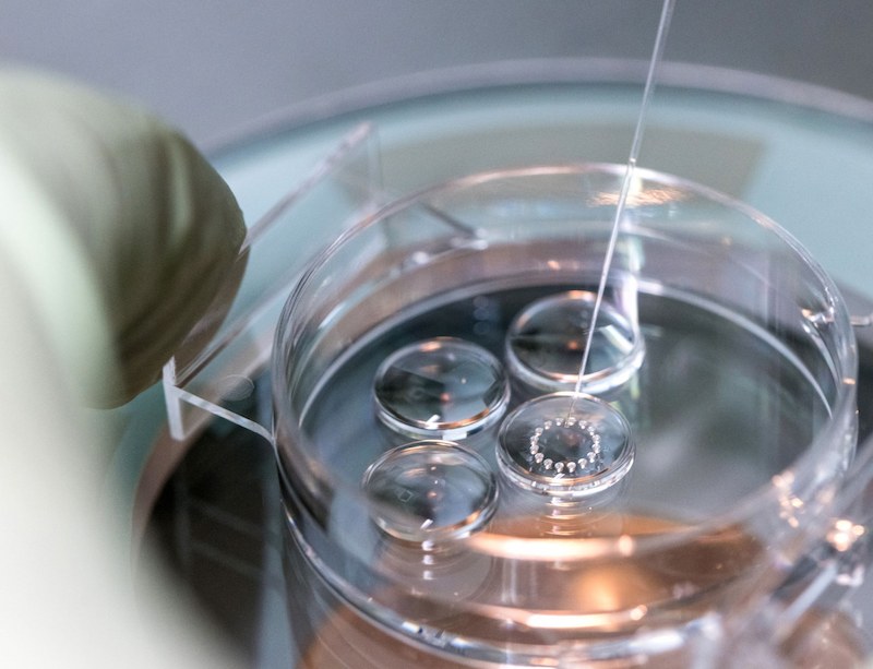 Tinh trùng yếu ảnh hưởng không nhỏ đến kết quả IVF Tinh trùng yếu ảnh hưởng không nhỏ đến kết quả IVF