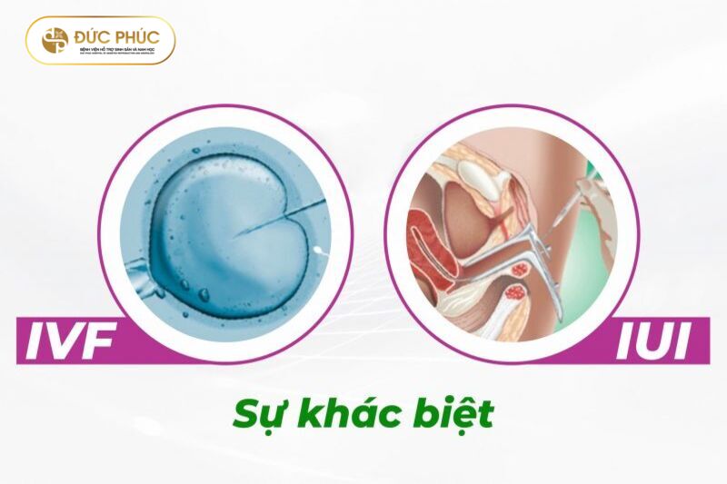 Phân biệt IUI và IVF