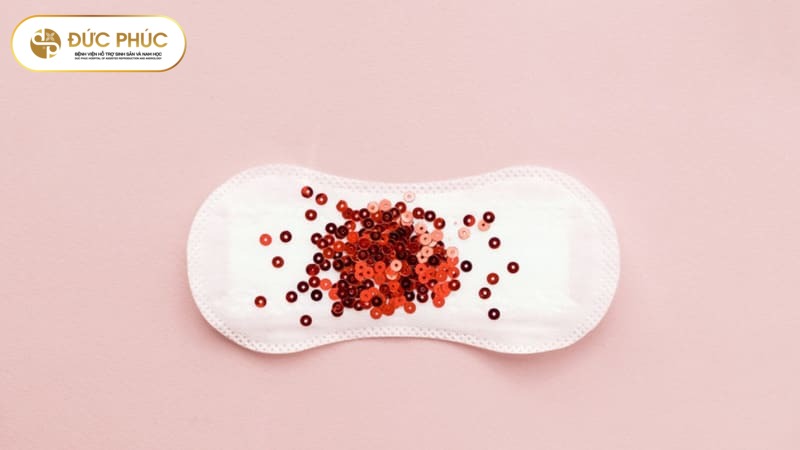 Chu kỳ kinh nguyệt bất thường là dấu hiệu vô sinh ở nữ