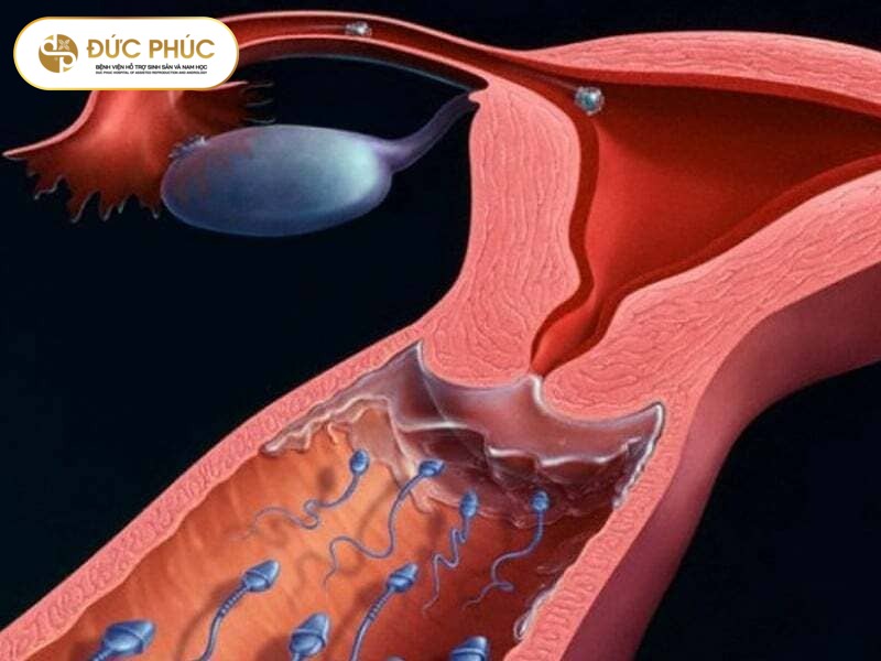 Niêm mạc tử cung lý tưởng 8 đến 12mm giúp tăng tỷ lệ đậu thai