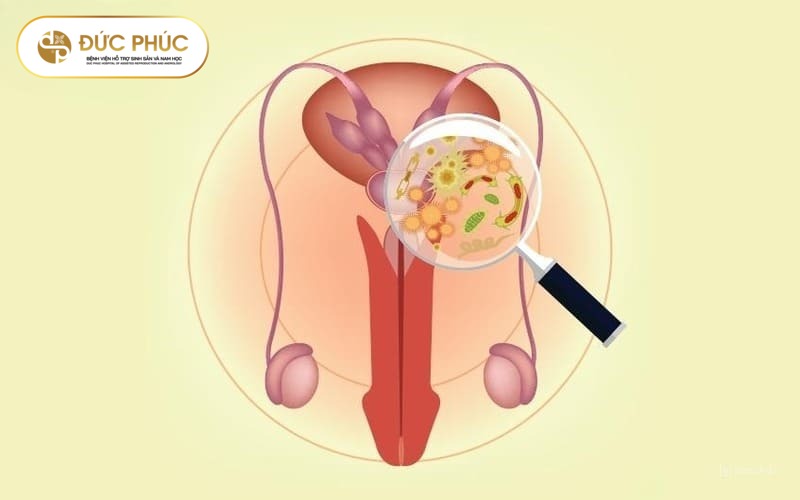 Nguyên nhân gây bệnh viêm tuyến tiền liệt