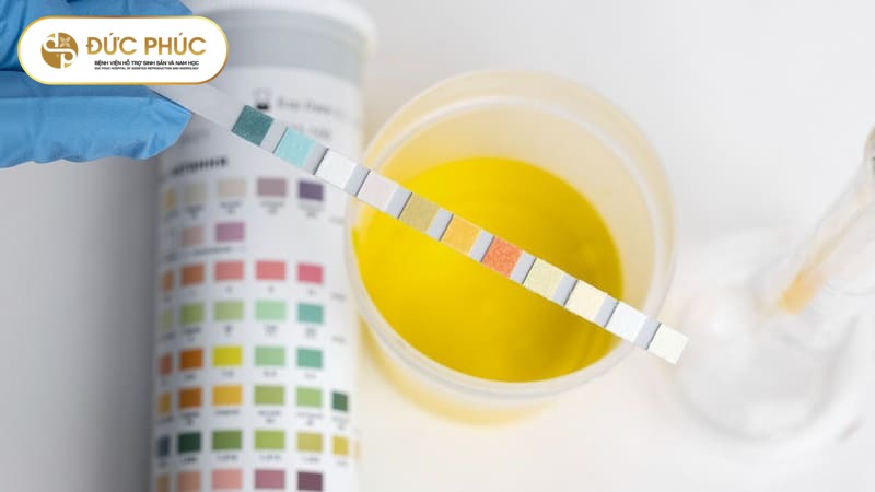 Xét nghiệm nước tiểu
